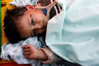 A&nbsp;Palestinian&nbsp;child&nbsp;wounded&nbsp;in&nbsp;the&nbsp;Israeli&nbsp;offensive&nbsp;arrives&nbsp;at&nbsp;the&nbsp;Rafah&nbsp;border&nbsp;crossing&nbsp;between&nbsp;the&nbsp;Gaza&nbsp;Strip&nbsp;and&nbsp;Egypt.(AFP/Khaled&nbsp;Desouki)
