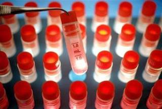 Ampoules containing a medium for stem cell storage are displayed in north London, May 19, 2004.(Peter Macdiarmid/Reuters)