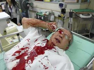 Sondhi Limthongkul, founder of the People's Alliance for Democracy (PAD), lies injured in a hospital in Bangkok April 17, 2009. REUTERS/Manager Newspaper