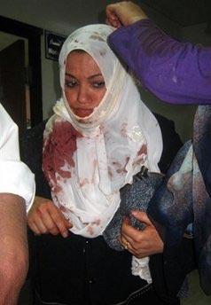 An&nbsp;injured&nbsp;women&nbsp;is&nbsp;treated&nbsp;at&nbsp;a&nbsp;hospital&nbsp;after&nbsp;a&nbsp;double&nbsp;suicide&nbsp;bombing&nbsp;in&nbsp;in&nbsp;Baghdad.&nbsp;Two&nbsp;female&nbsp;suicide&nbsp;bombers&nbsp;struck&nbsp;a&nbsp;major&nbsp;Shiite&nbsp;shrine&nbsp;in&nbsp;Baghdad,&nbsp;killing&nbsp;at&nbsp;least&nbsp;58&nbsp;people&nbsp;amid&nbsp;a&nbsp;brutal&nbsp;spike&nbsp;of&nbsp;attacks&nbsp;nine&nbsp;weeks&nbsp;before&nbsp;US&nbsp;troops&nbsp;are&nbsp;to&nbsp;withdraw&nbsp;from&nbsp;Iraqi&nbsp;cities.(AFP/Khalil&nbsp;al-Murshidi)&nbsp;