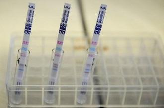 Flu&nbsp;tests&nbsp;strips&nbsp;can&nbsp;be&nbsp;seen&nbsp;in&nbsp;a&nbsp;laboratory.&nbsp;(AFP/DDP/File/Nigel&nbsp;Treblin)