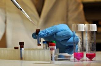Three strains of the A-H1N1 influenza virus are being donated by the United States for medical analysis in China. (AFP/File/Leon Neal)