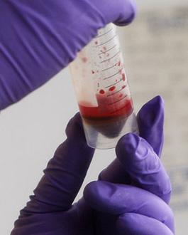 A&nbsp;safety&nbsp;and&nbsp;security&nbsp;manager&nbsp;in&nbsp;a&nbsp;Category&nbsp;4&nbsp;laboratory&nbsp;handles&nbsp;an&nbsp;uninfected&nbsp;blood&nbsp;sample&nbsp;used&nbsp;as&nbsp;a&nbsp;control&nbsp;against&nbsp;Influenza&nbsp;A&nbsp;samples&nbsp;at&nbsp;the&nbsp;National&nbsp;Institute&nbsp;of&nbsp;Medical&nbsp;Research&nbsp;in&nbsp;London&nbsp;May&nbsp;1,&nbsp;2009.&nbsp;(Xinhua/Reuters,&nbsp;File&nbsp;Photo)