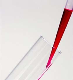 British researchers found that using a blood test and an ultrasound scan together may detect ovarian cancer in its early and more curable stages.(File photo)
