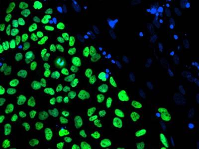 A human embryonic stem cell line derived at Stanford University is seen in this handout photo released to Reuters by the California Institute for Regenerative Medicine, March 9, 2009. The line was derived under controlled conditions that could make the cells useful for transplantation. The nuclei in green are stained for a protein that is found only in embryonic stem cells while blue represents the DNA of the surrounding feeder cells. U.S. President Barack Obama lifted restrictions on federal funding of human embryonic stem cell research, angering abortion opponents but cheering those who believe the study could produce treatments for many diseases.(Xinhua/Reuters Photo